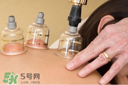 真空拔罐有用嗎？真空拔罐多長(zhǎng)時(shí)間合適