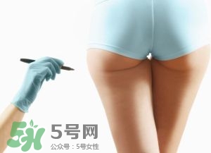 吸脂減肥副作用有哪些？吸脂減肥可靠嗎？