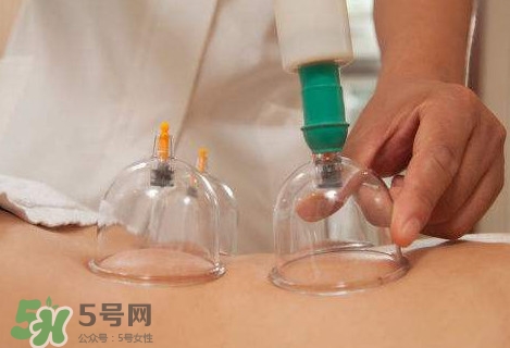 真空拔罐有用嗎？真空拔罐多長(zhǎng)時(shí)間合適