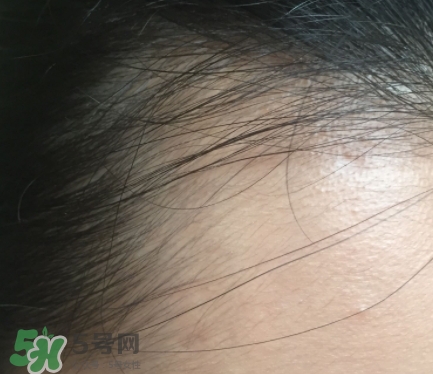 發(fā)際線粉要卸妝嗎_怎么卸？