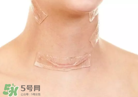 硅膠疤痕貼有用嗎？硅膠疤痕貼效果怎么樣？