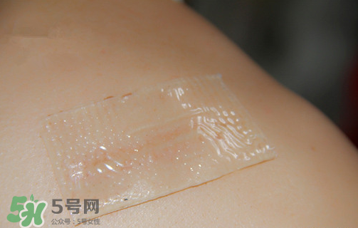 仙卡疤痕貼有用嗎？仙卡疤痕貼效果怎么樣？