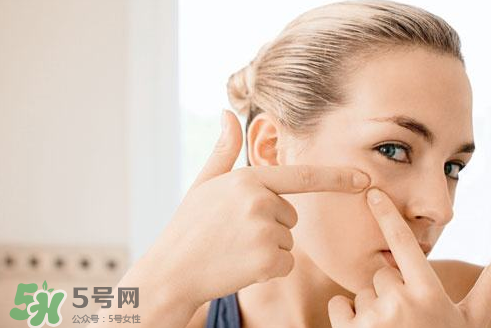 暗瘡可以擠壓?jiǎn)幔坑托院腕a臟肌膚會(huì)容易有暗瘡嗎？