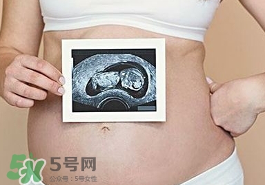 雙子宮可以上環(huán)嗎？雙子宮上環(huán)要注意哪些？