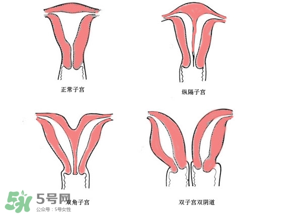 雙子宮是什么意思？雙子宮可以順產(chǎn)嗎？