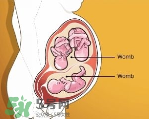雙子宮是什么意思？雙子宮可以順產(chǎn)嗎？