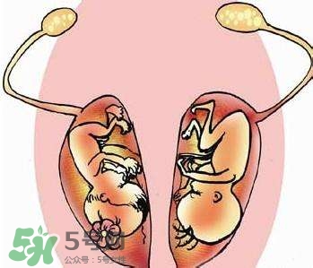 雙子宮對懷孕有影響嗎？雙子宮懷孕要注意什么？
