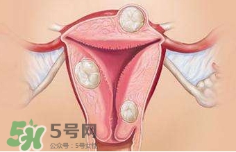 雙子宮可以上環(huán)嗎？雙子宮上環(huán)要注意哪些？