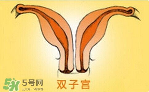 雙子宮是什么意思？雙子宮可以順產(chǎn)嗎？