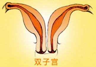 雙子宮是什么意思？雙子宮可以順產(chǎn)嗎？