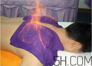 火療真的能治病嗎？火龍液的功效與作用
