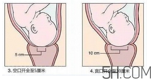 內(nèi)檢是什么感覺？內(nèi)檢有男醫(yī)生嗎？