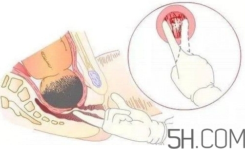 內(nèi)檢是什么感覺？內(nèi)檢有男醫(yī)生嗎？