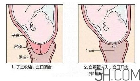 內(nèi)檢是什么感覺？內(nèi)檢有男醫(yī)生嗎？