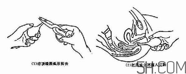 開(kāi)塞露怎么用？開(kāi)塞露用后多久會(huì)排便？