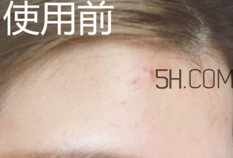 essence雙色遮瑕膏怎么用？essence雙色遮瑕膏使用心得