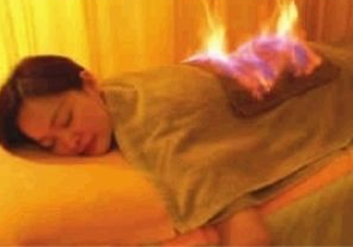 火療能治婦科病嗎？火療能去濕氣嗎