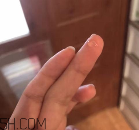 倍舒痕可以去痘印嗎？倍舒痕能涂在痘痘上嗎？