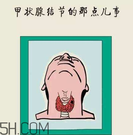 為什么會(huì)得甲狀腺結(jié)節(jié)？甲狀腺節(jié)結(jié)是什么？