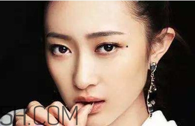 痣是怎么形成的？女人痣長哪里最有福氣