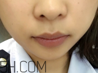小蜜蜂細(xì)致修護(hù)唇膏很油嗎？夏天用合適嗎？