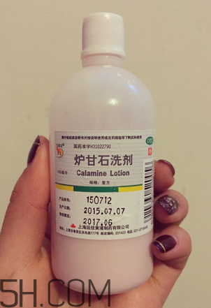 爐甘石洗劑多少錢一瓶？爐甘石洗劑治痤瘡嗎？