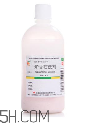 爐甘石洗劑是激素藥嗎？爐甘石洗劑是處方藥嗎？