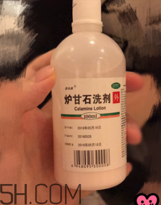 爐甘石洗劑是洗還是擦？爐甘石洗劑是什么顏色？
