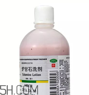 爐甘石洗劑是洗還是擦？爐甘石洗劑是什么顏色？