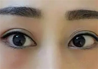 怎么紋美瞳線好看？紋美瞳線的危害