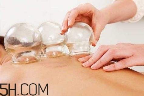 拔罐可以治療鼻炎嗎？鼻炎拔罐拔哪里？