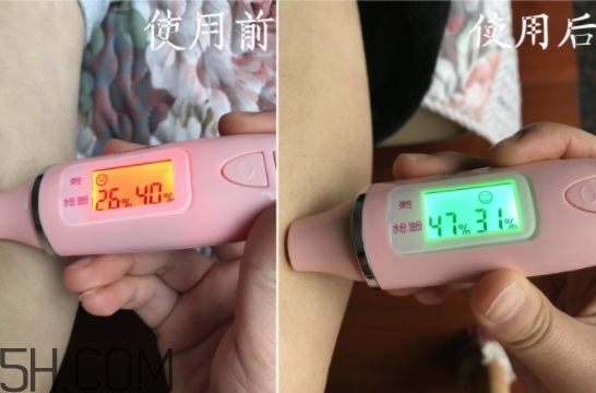 水楊酸可以去黑頭嗎？水楊酸可以去閉口嗎