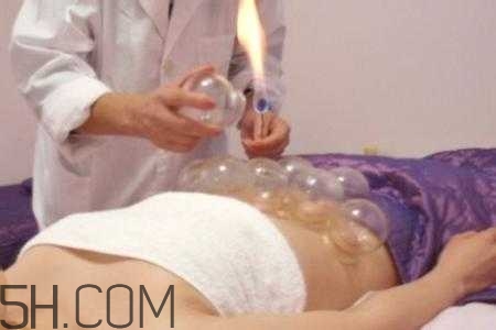腹部拔罐可以減肥嗎？腹部拔罐拔哪個(gè)位置？