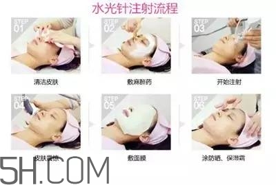打水光針多久打一次？水光針的誤區(qū)