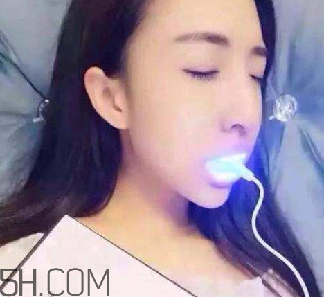 美牙儀可以兩個(gè)人用嗎？美牙儀用多久才有作用？