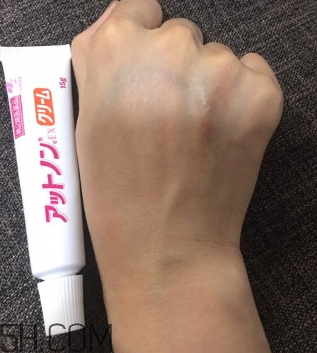 小林制藥祛疤膏有效嗎？小林制藥祛疤膏怎么樣？