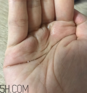 雪肌精卸妝油糊眼睛嗎？雪肌精卸妝油悶痘嗎？