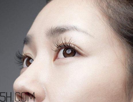 上瞼提肌手術(shù)有必要嗎？上瞼提肌后是永久的嗎？