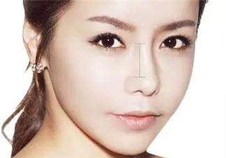 達(dá)拉斯隆鼻是什么材料？達(dá)拉斯隆鼻怎么樣？