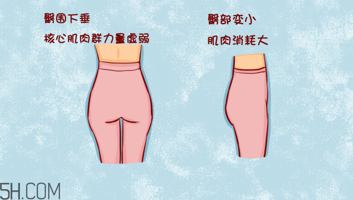 臀部護理對健康有什么影響？日常如何保養(yǎng)臀部健康？