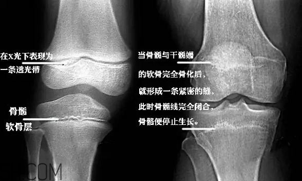 孩子學(xué)街舞好不好？學(xué)街舞好處多多