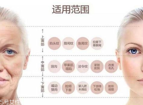大v線會(huì)斷嗎？一定要選擇正規(guī)整形醫(yī)院
