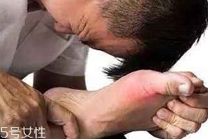 痛風可以治愈嗎？無法治愈但能控制