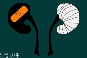 腎病為什么會(huì)發(fā)展到尿毒癥？這些因素一定要注意