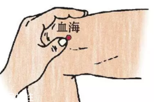 濕疹怎么治才管用？?jī)?nèi)外同治是關(guān)鍵