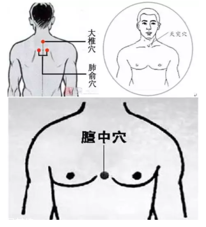 吮痧有什么療效？最溫柔的治病方法