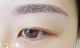 激光洗眉恢復(fù)期有疤痕怎么辦？激光洗眉毛之后正確護(hù)理方法