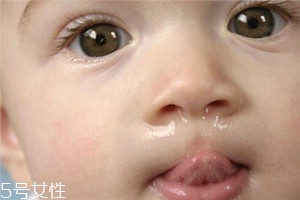 冬季寶寶流鼻涕是什么原因？教你幾招輕松應對