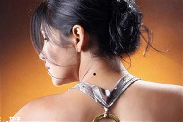 脖子后面有痣代表什么？10大身體缺陷是好事