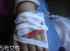輸液治療不適合哪些??？過敏反應(yīng)危害大